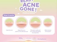 True to Skin Launching Produk Terbaru ‘Ready Acne Gone’