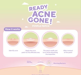 True to Skin Launching Produk Terbaru ‘Ready Acne Gone’